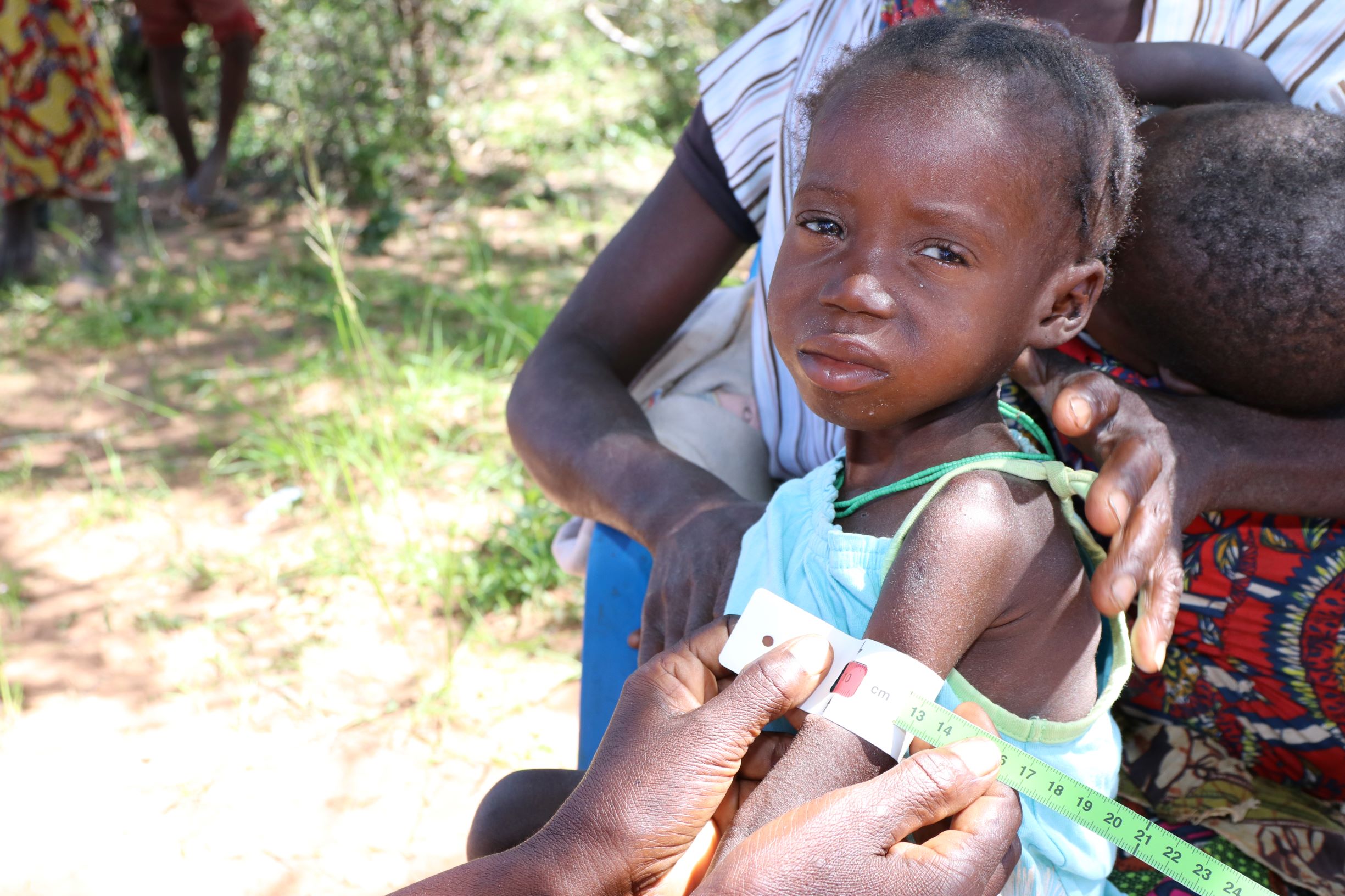 fighting-severe-malnutrition-in-southern-angola-world-vision-international